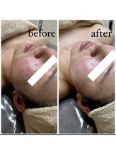 サロナプア(Salona Pua)/