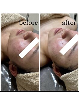 サロナプア(Salona Pua)/