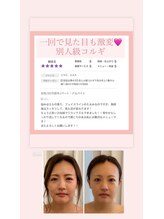 ベリンダ(belinda)/