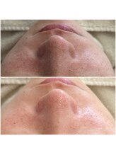 マヴィ 高槻店(MavY.)/ガサガサの理由は・・