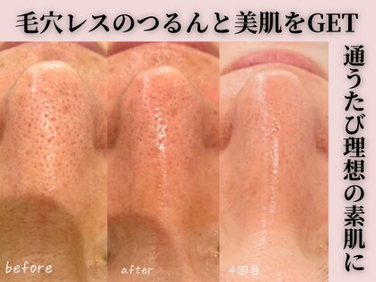 ミータイム(Me Time)の写真