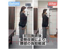 アンティオール 札幌店/40代女性　慢性腰痛