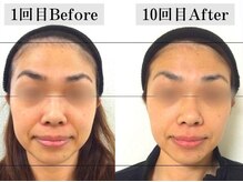 プライベートエステサロン キュテラ(Cutella)の雰囲気(当店人気No.1コルギはしっかり身体からほぐして理想の小顔へ)