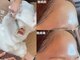オプテリオンの写真/【毛穴汚れをごっそり洗浄/オゾン泡洗顔】ざらつき/ごわつきを改善し透明感ある毛穴レスな美肌に![八丁堀]