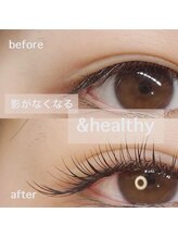 アイビー(Ivy)/アンドヘルシー