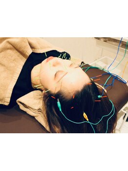 小顔になりたい