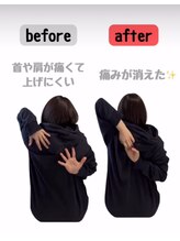 フーレ(Foule)/【育児中の首肩こり】