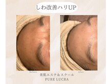 ピュアルクラ ＰＵＲＥ ＬＵＣＲＡの雰囲気（結果重視☆人気のハーブピーリングでしわ改善！マイナス５歳肌へ）