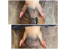 ミース 北九州店/『うなじビフォーアフター』