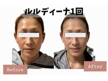 ヨサパーク ポノン(YOSA PARK ponon)/【Before→After】