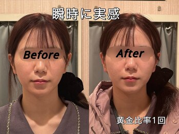 薬手名家 心斎橋店/お客様ビフォーアフター