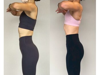 ラグジュアリースタイルビューティプログラム(Luxury Style beauty program)/インナーマッスルの変化(40代)