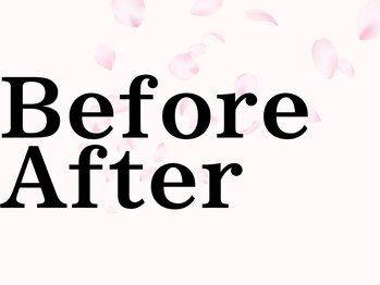 シミケア専門店 SAKURA 平塚店/【平塚ハーブピーリング】