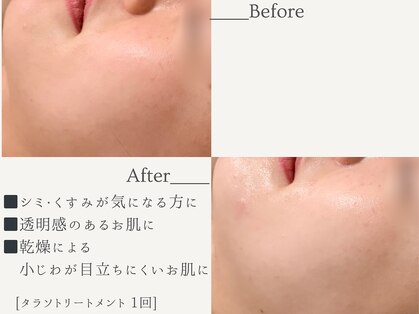 エミィ(emmy)の写真