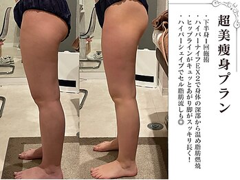 ラブミー 渋谷本店(LoveMe)/骨盤/下半身痩せ/痩身/あしやせ