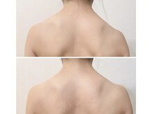 サロン ド メグリィ(Salon de meguli)の雰囲気(バストを綺麗にする事で、背中も綺麗になります。)