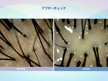 アンス(anth:)/お客様の仕上がり