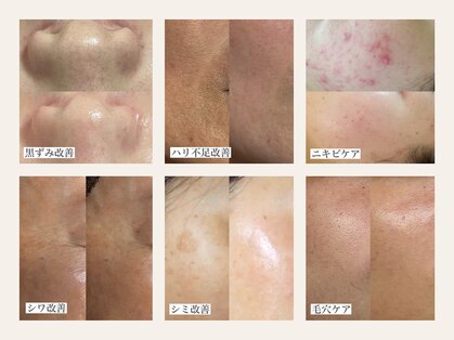 ベルスキン(Bell skin)の写真