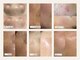 ベルスキン(Bell skin)の写真