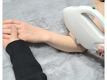 ベリッシア(BELLISSIA)/うで脱毛施術写真