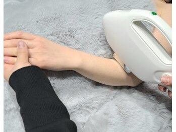 ベリッシア(BELLISSIA)/うで脱毛施術写真