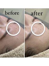 サロナプア(Salona Pua)/