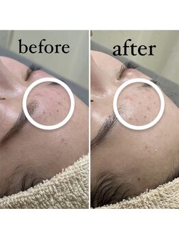 サロナプア(Salona Pua)/