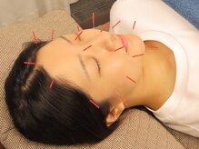 トータルケア鍼灸院