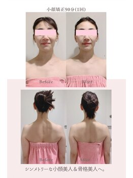 トゥインクル 麻布(twinkle)/港区/南麻布/白金/広尾/小顔矯正