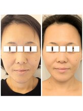 イーオ(io)/エイジングケアで若見え！