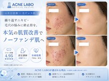 アクネラボ 梅田店(ACNE LABO)