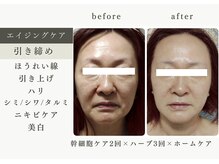 ティアス(t-us)の雰囲気（ハリ艶・透明感欲しい方に！弛み、シミ、シワのお悩みを改善）