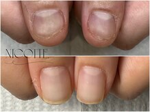 ニコッテ 本厚木(nicotte.)の雰囲気（土台を大切に、一緒に育てながらネイルを楽しむ自爪育成）