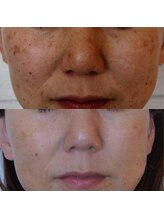 エトル(etole)/40代お客様症例写真