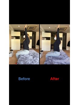 整体院 快/肩の可動域　ビフォーアフター