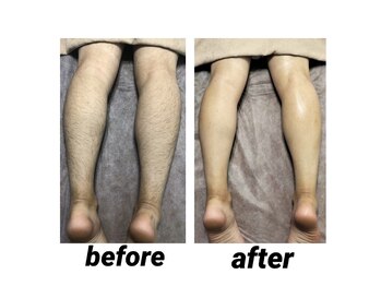 ビカム(become)/剛毛さんにも！