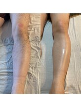 ララルアナ(Lara luana)/シュガーリングでうる艶美脚へ♪