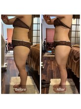 アムスパ(Aum Spa)/フォースカッター痩身