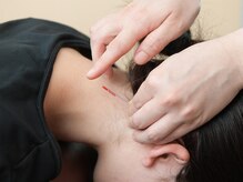 さくらリバース治療院 瑞穂/鍼