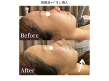 フォルチェ 春日(Folche)/年代問わず人気のお施術です◎