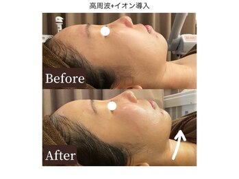 フォルチェ 春日(Folche)/年代問わず人気のお施術です◎