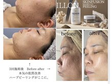 ラ ミュエル(La miel)の雰囲気（韓国3200ヶ所で大人気！本気のILLONハーブピーリングがここに。）