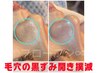 人気No2【脱!夏のテカリ肌】ハイドラ毛穴洗浄で毛穴黒ずみ改善初回体験60分