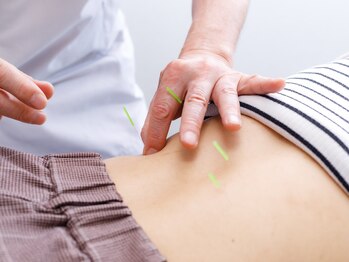 鍼灸マッサージ治療院 巡気堂/≪お試し鍼灸¥3,000≫