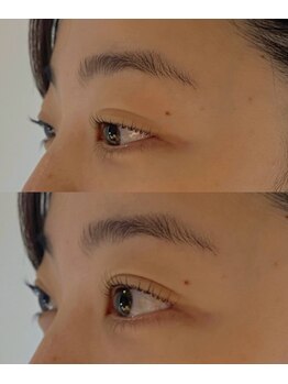 アーチ(arch)))/lash lift