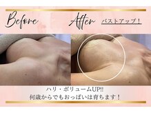 リーズリアン(Rises Lien)/【BeforeAfter】60代 バストUP!