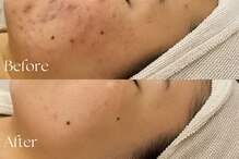 エンビロンサロン エイジングルーム ラヴィーア(Lavia)