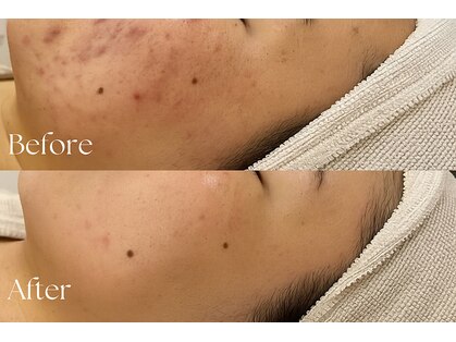 エンビロンサロン エイジングルーム ラヴィーア(Lavia)の写真