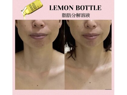 グレイスシャイン(GraceShine)の写真