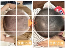 ラフィング(Laughing)/赤ちゃん整体